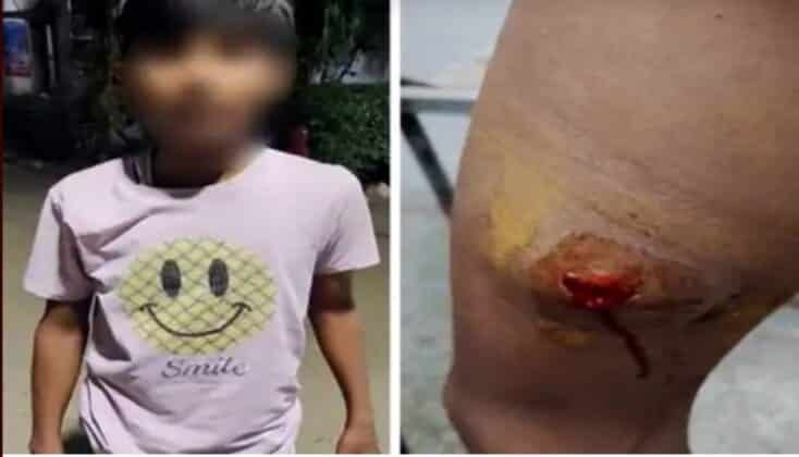 কানপুরে ১৩ বছরের মুসলিম শিশুকে ‘জয় শ্রী রাম’ না বলায় কাঁচের বোতল দিয়ে আঘাত!